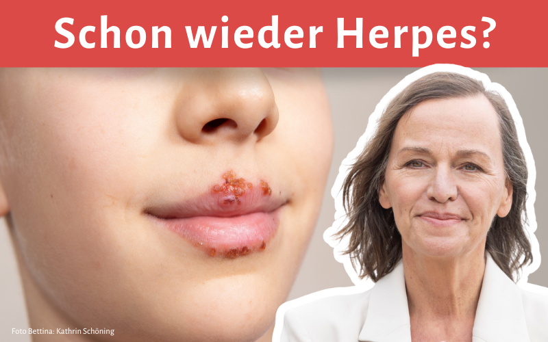 Was steckt hinter Deinem Herpes – und wie kannst Du ihn energetisch heilen